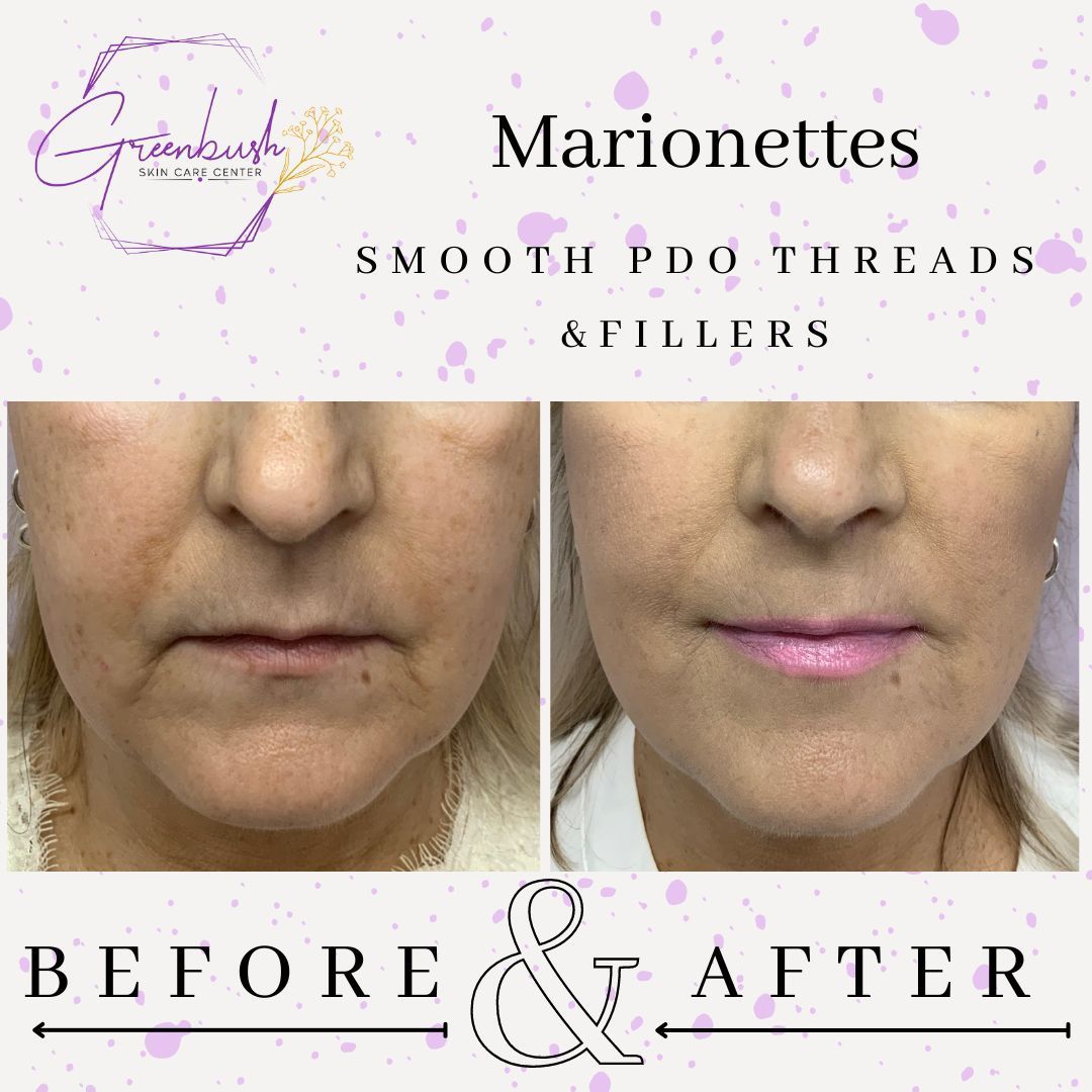 Before & After 36