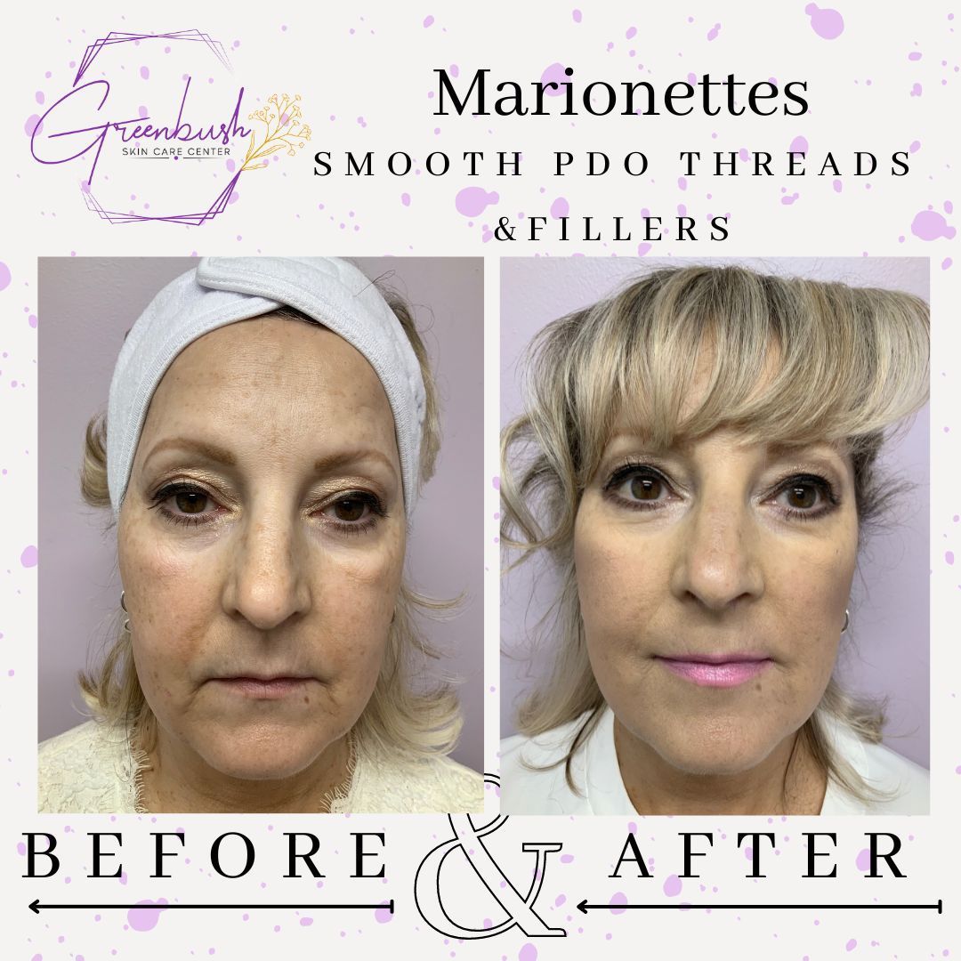Before & After 37