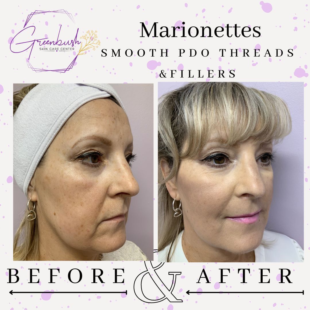 Before & After 38
