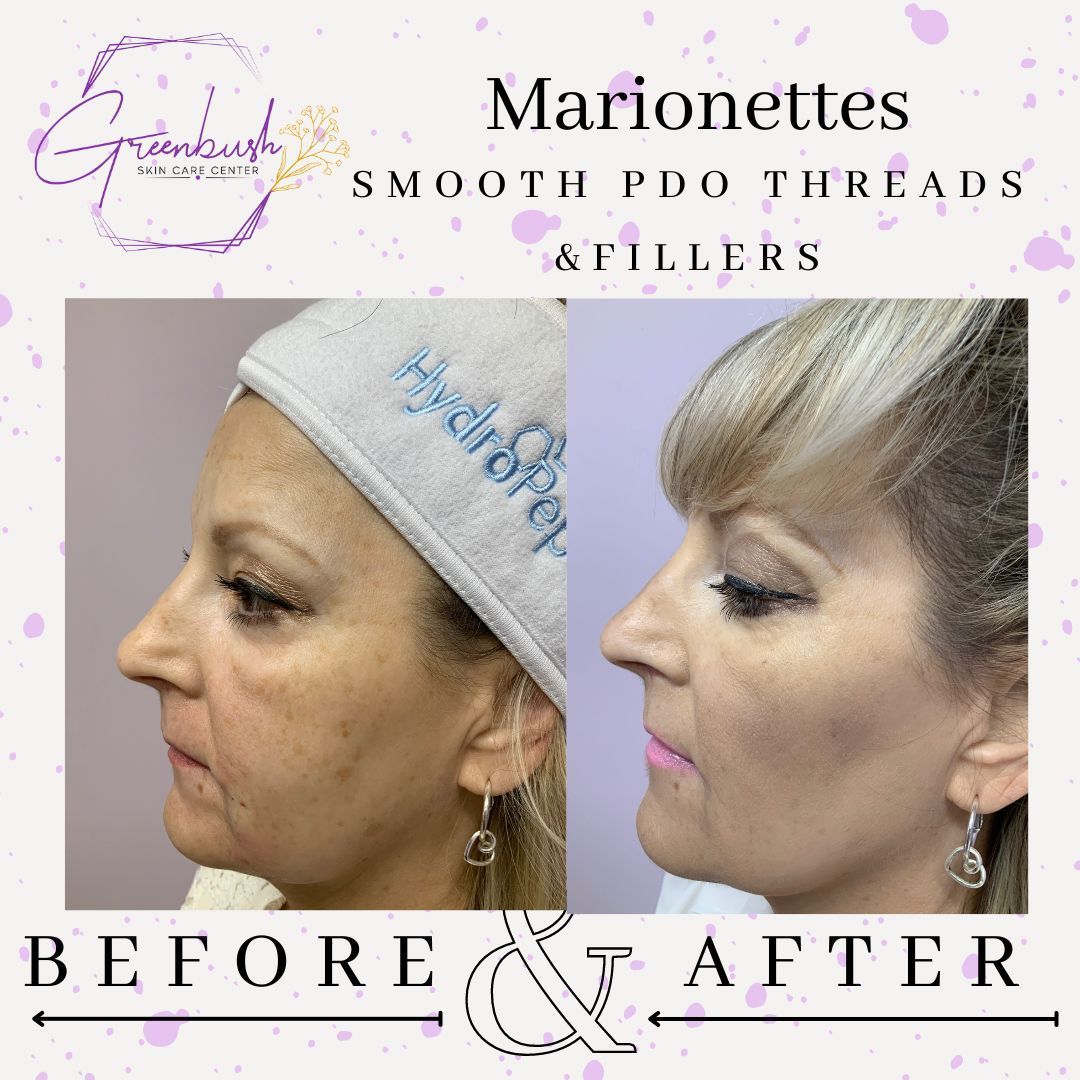 Before & After 39