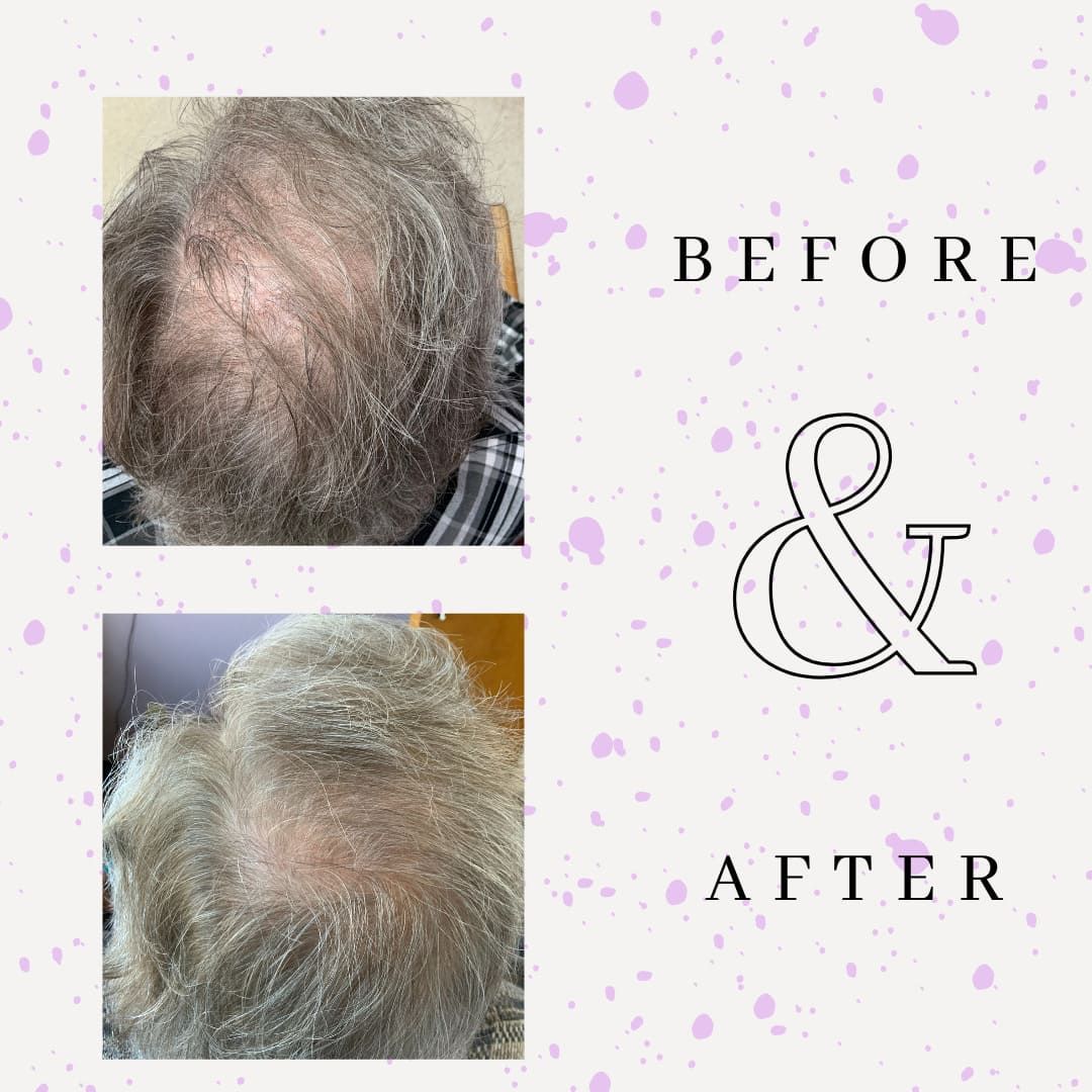 Before & After 1