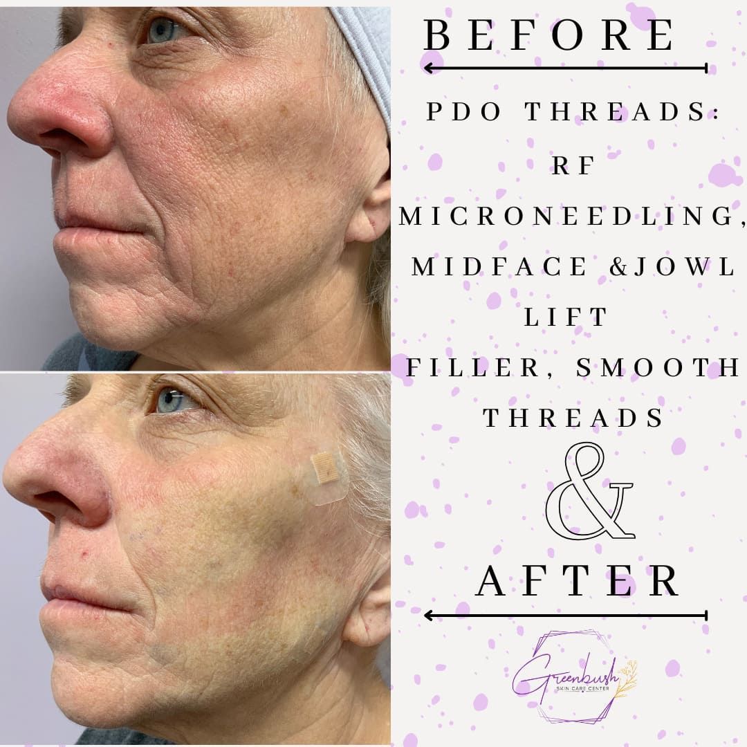Before & After 10