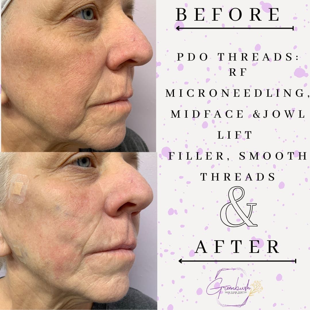 Before & After 11