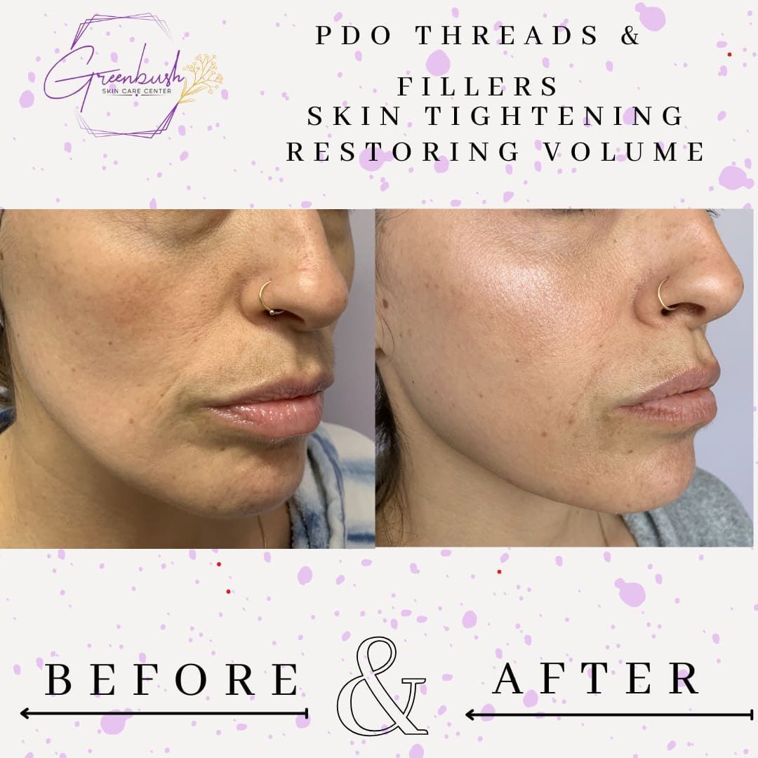 Before & After 12