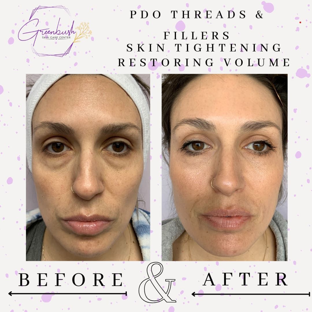 Before & After 13