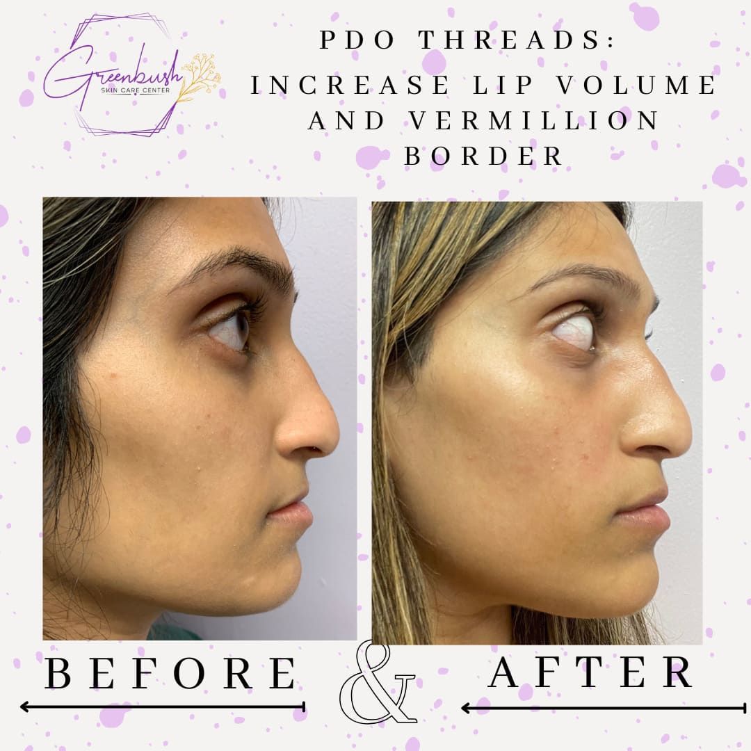 Before & After 15
