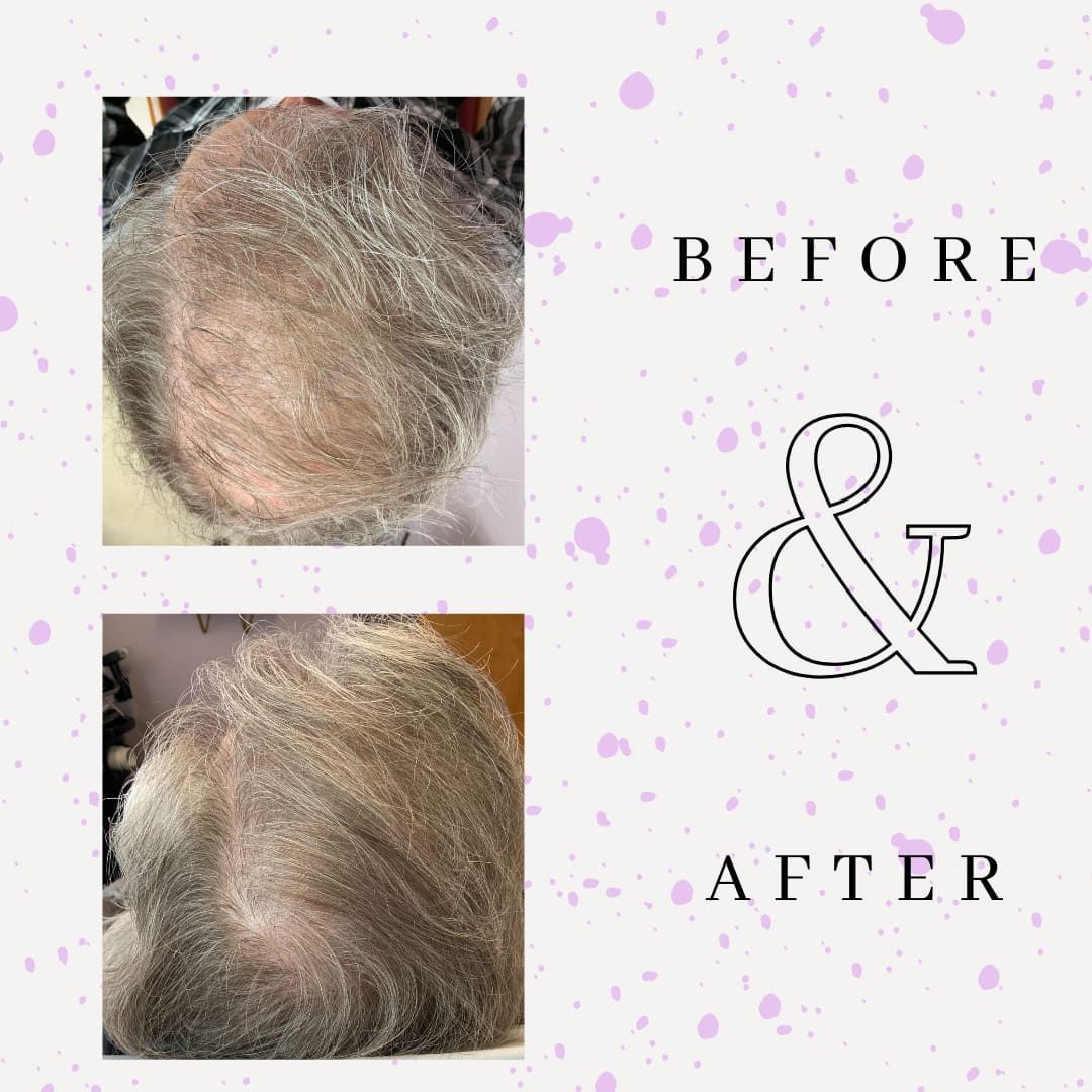 Before & After 2