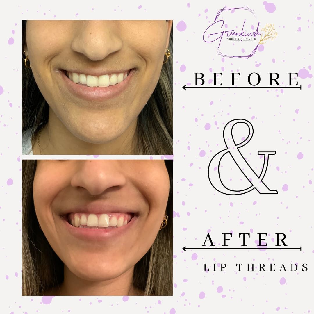 Before & After 17