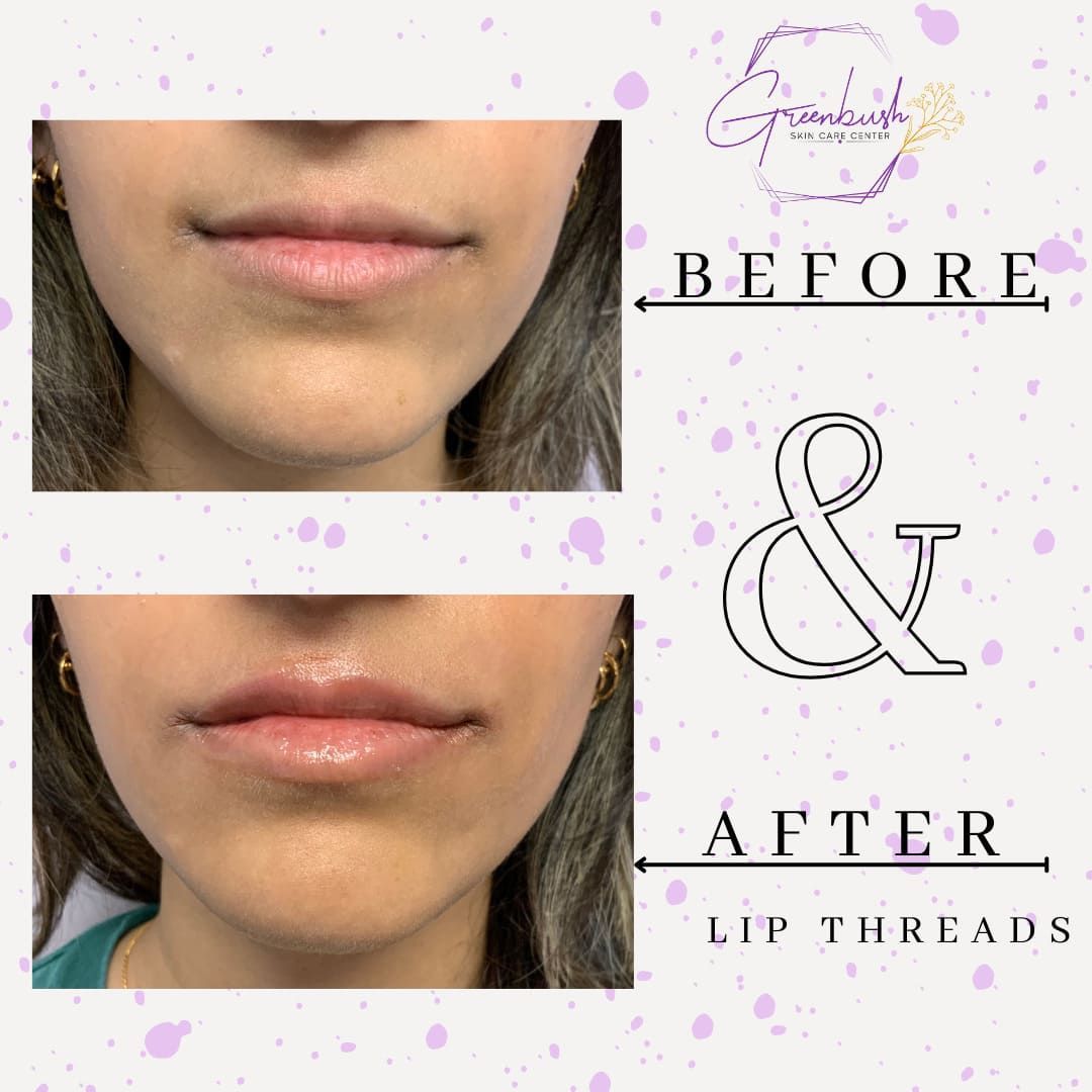Before & After 18