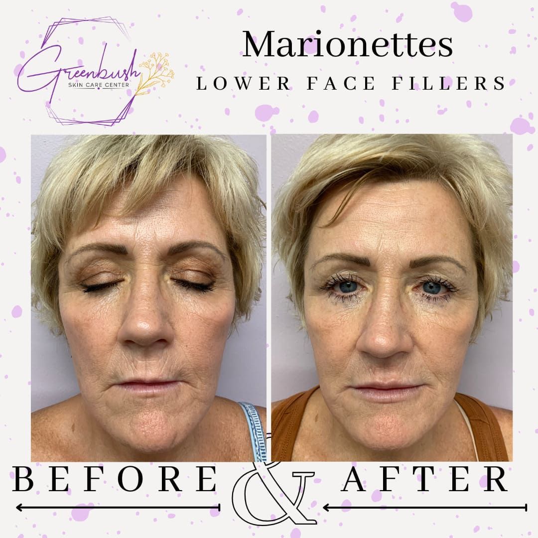 Before & After 20