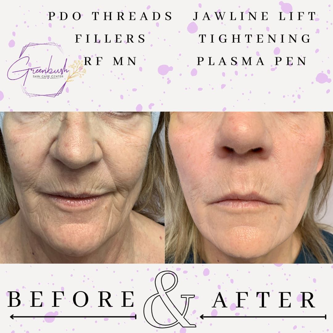 Before & After 21