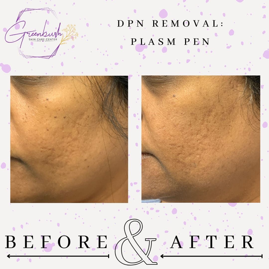 Before & After 23