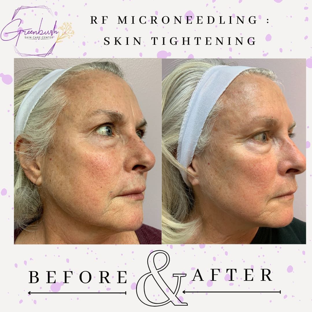 Before & After 27