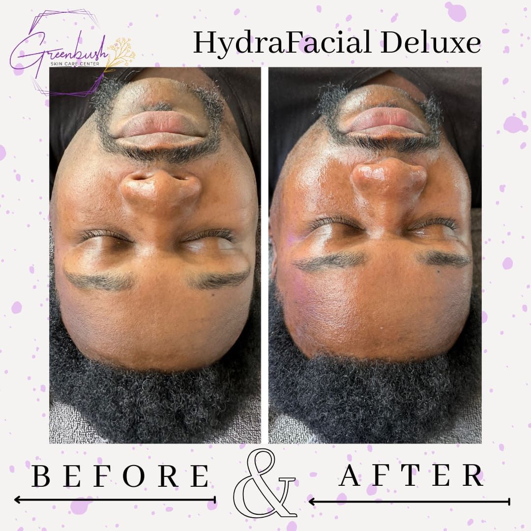 Before & After 4