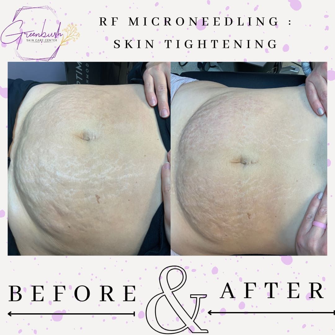 Before & After 34
