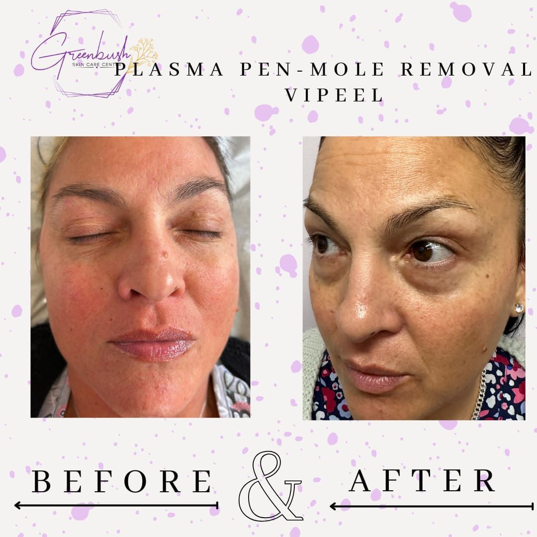 Before & After 5