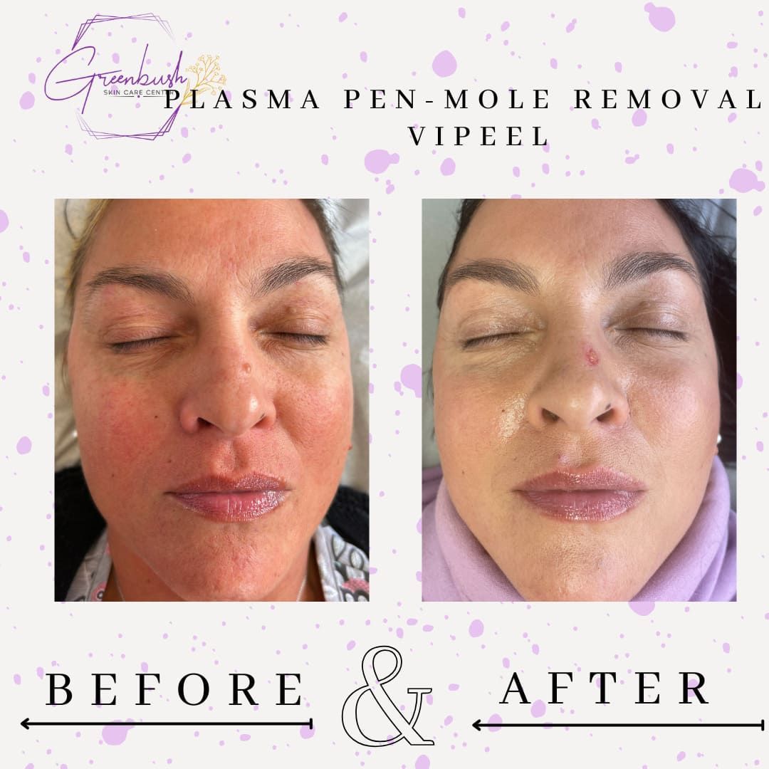 Before & After 6