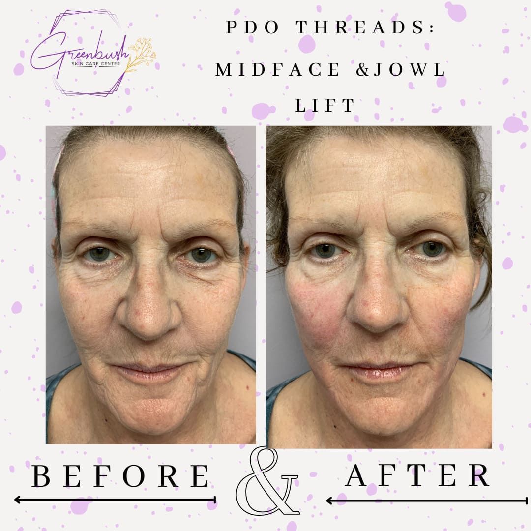 Before & After 7