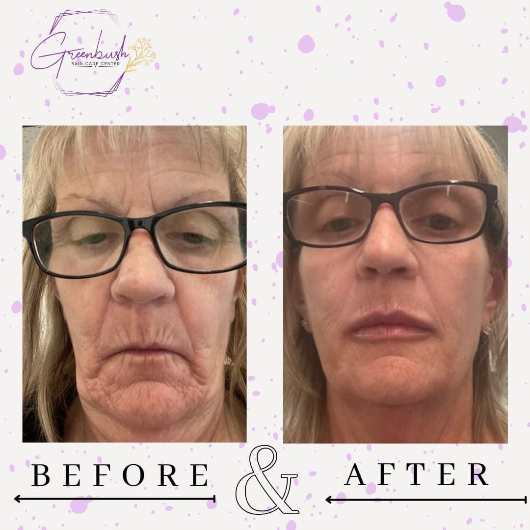 Before & After 8