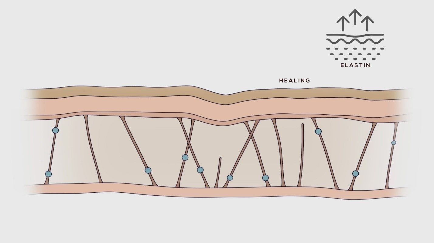 Fibroblast 2