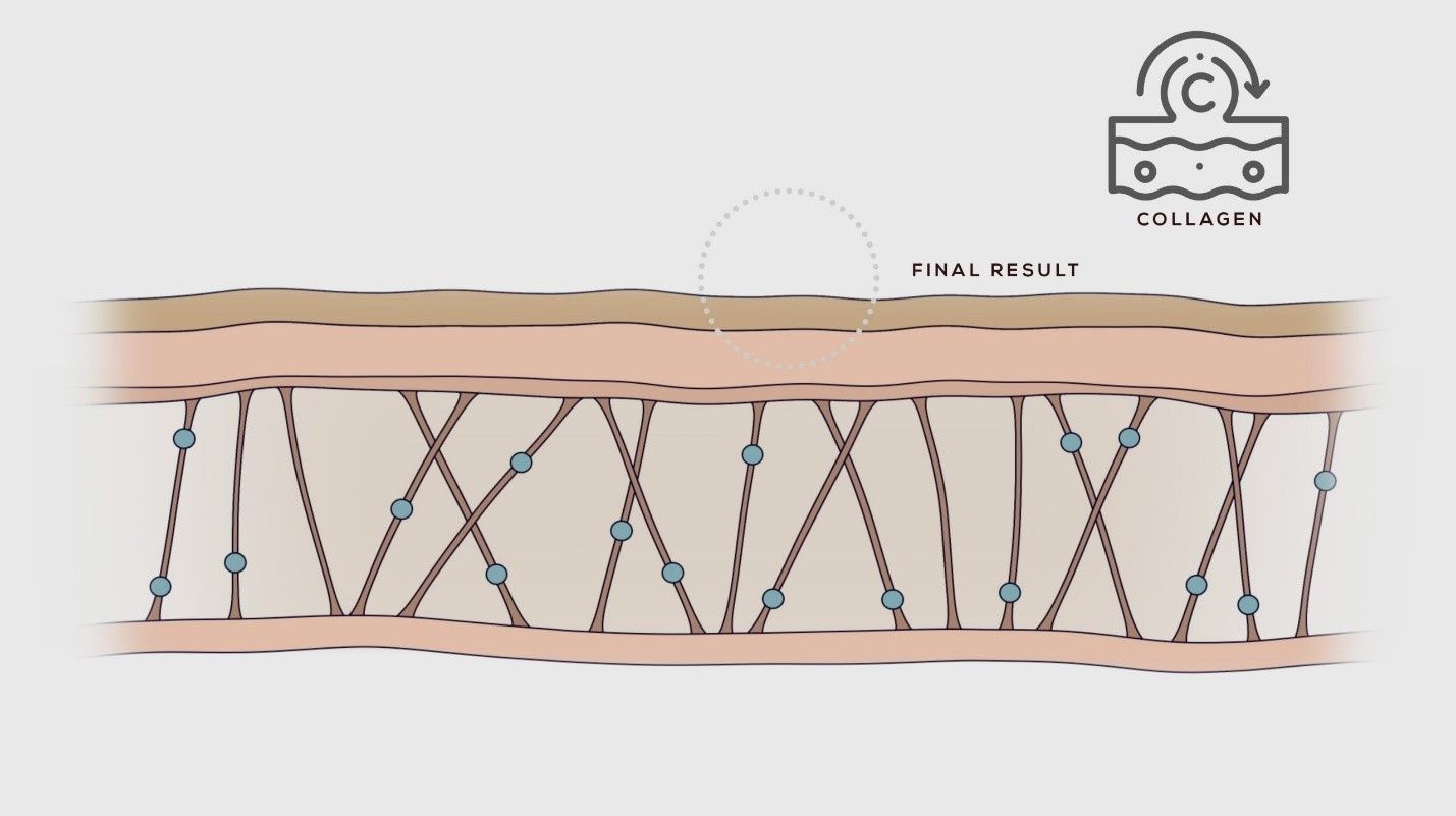 Fibroblast 3