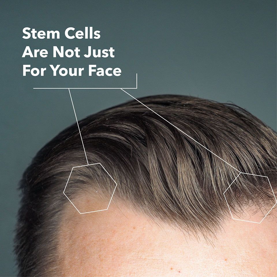 Hair Rejuvenation 4