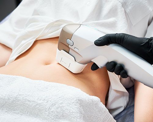 ¿Qué es la lipoescultura láser?