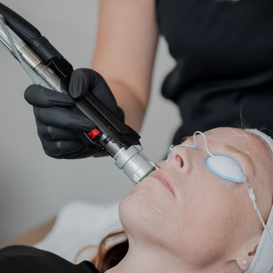 Alma Harmony XL Pro Lasers in Clovis, NM Medical Weight loss results in Clovis