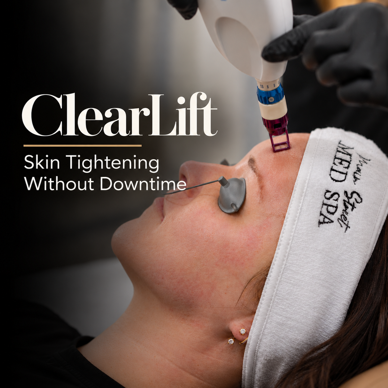 Laser handpiece for ClearLift non-ablative laser facelift in Clovis