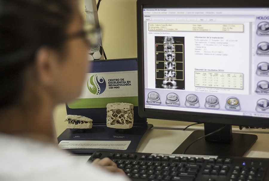 Una mujer mira una pantalla de computadora con una imagen de una columna vertebral en ella.