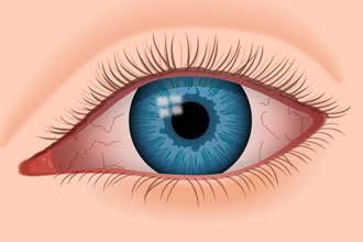 Un primer plano de un ojo rojo con una pupila azul.