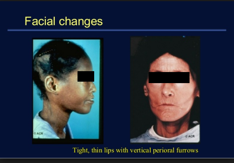 Dos fotografías del rostro de una mujer con la leyenda cambios faciales