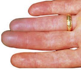 Un primer plano de la mano de una persona con un anillo de oro en el dedo.