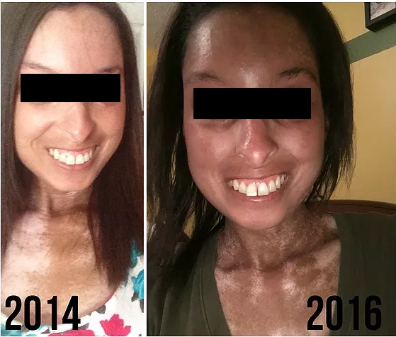 Se muestra el rostro de una mujer en 2014 y 2016.