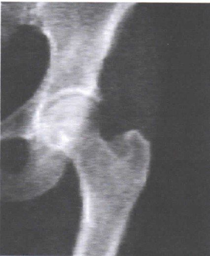 Una fotografía en blanco y negro de una articulación de la cadera.