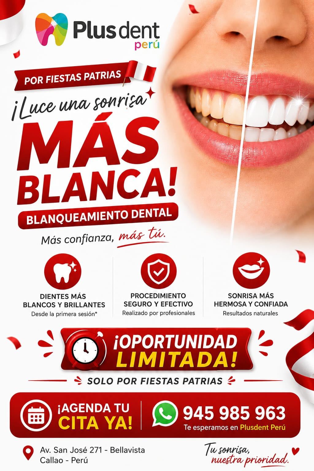 Una mujer se blanquea los dientes con blanqueador dental.