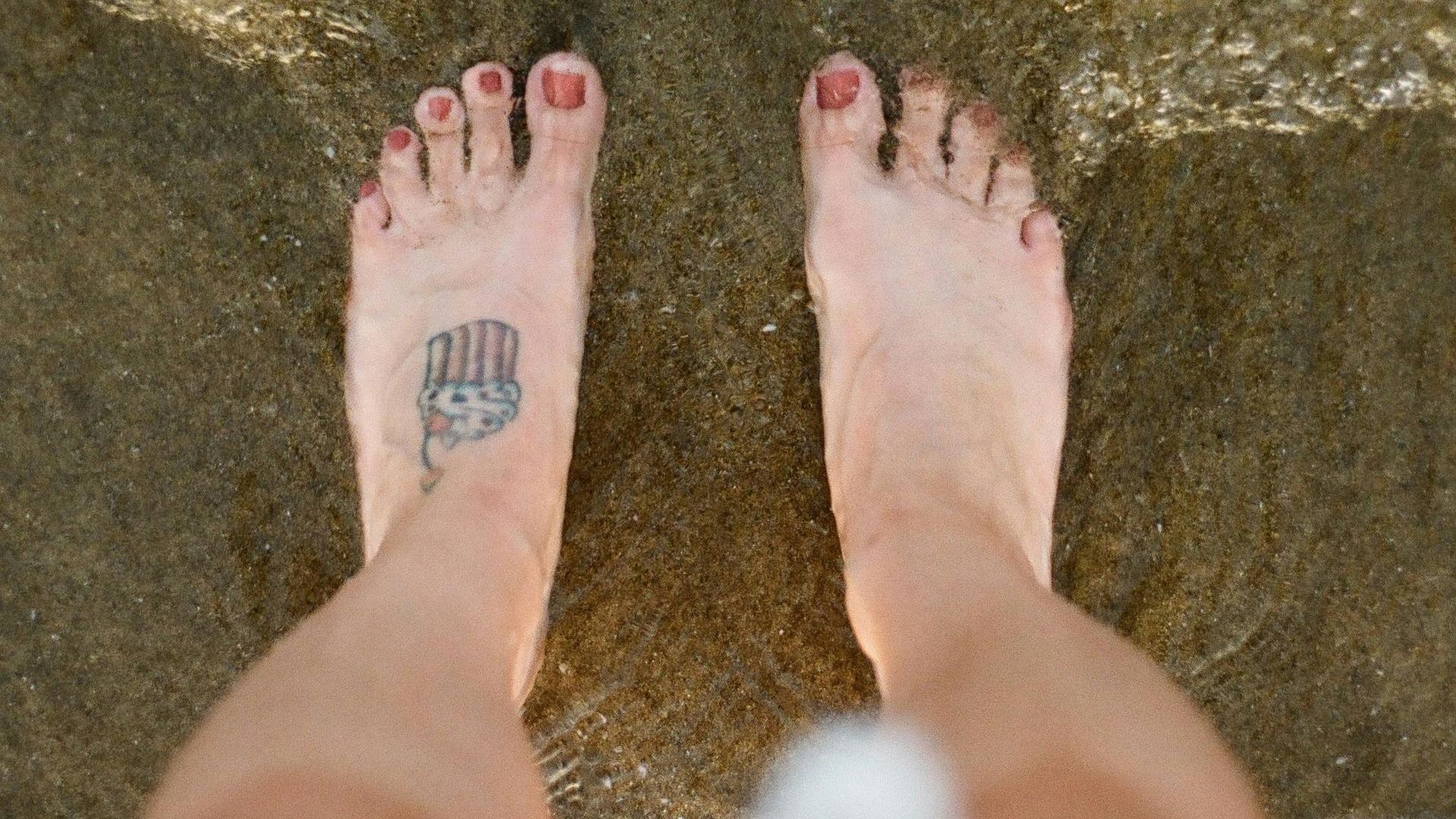How to remove Corns from toes?