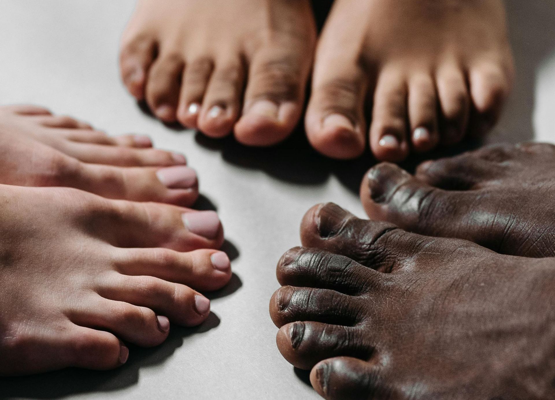 ingrowing toenails