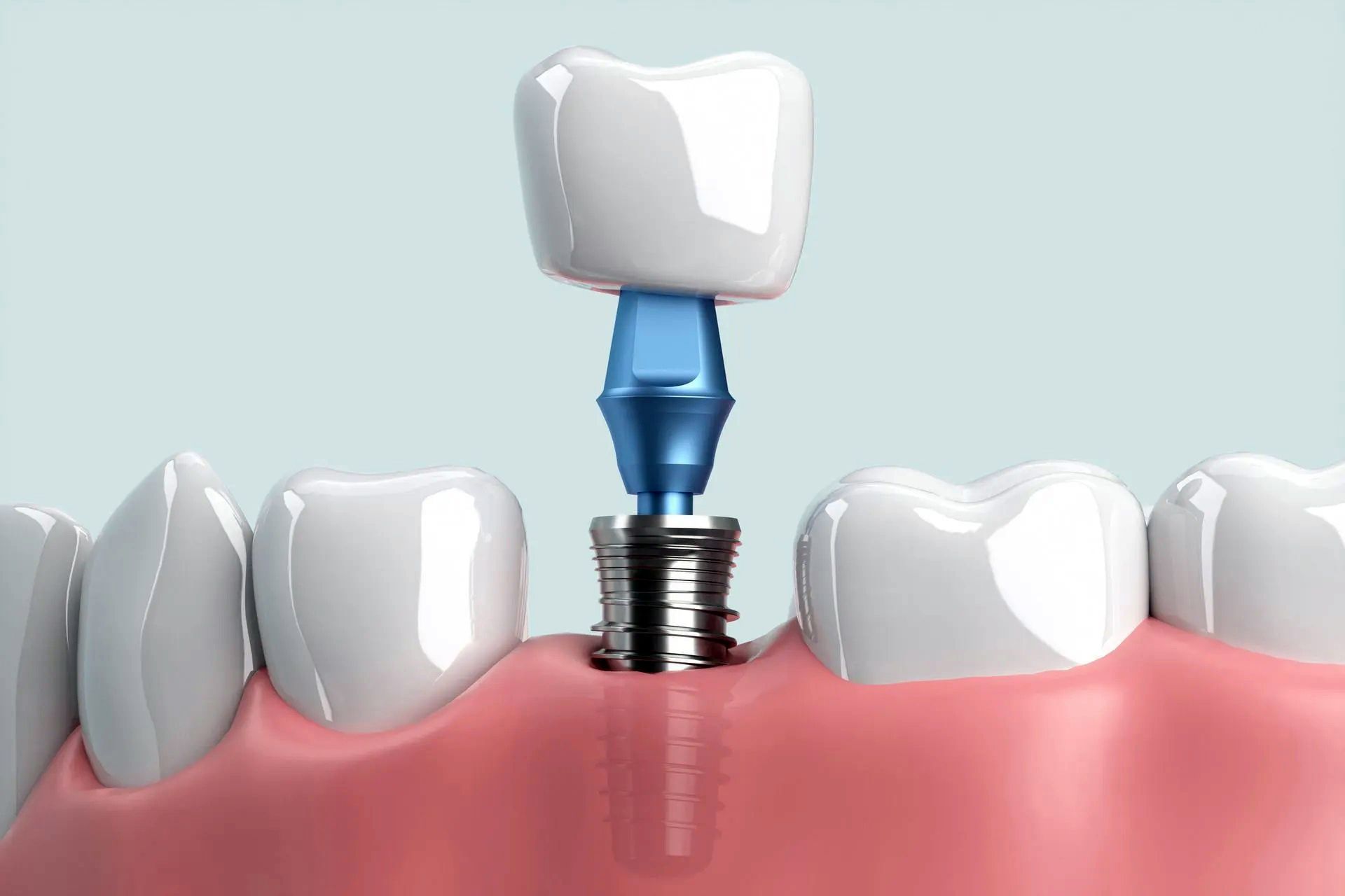 chirurgia dentale ed implantologia