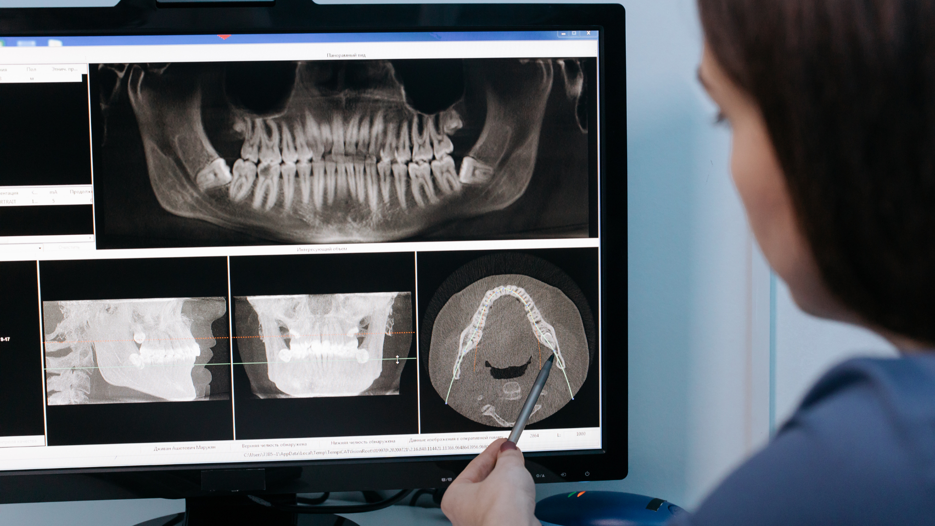 Dental tools in a tray on a purple surface next to a dental chair.