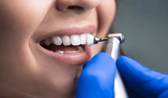 Dentist using a handheld tool on a patient’s teeth during a dental exam