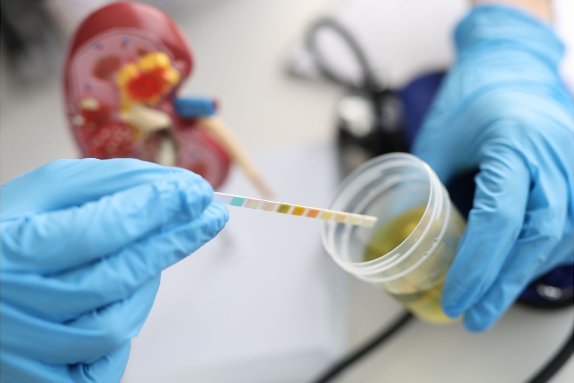 Person in blue gloves testing urine sample with a dipstick near a kidney model. Person in blue gloves testing urine sample with a dipstick near a kidney model.