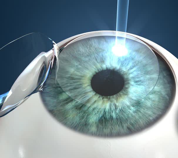 REFRACTIVE SERVICES