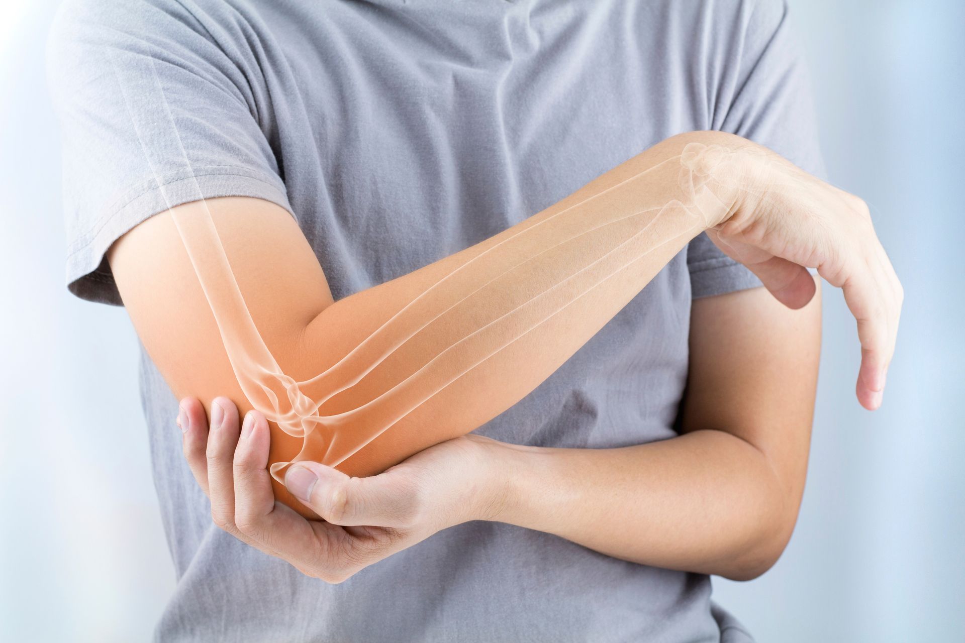 Foto Arthrose
