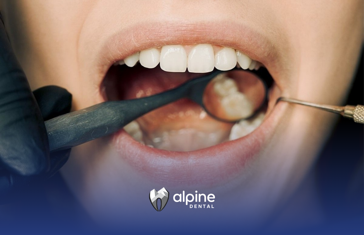 Signs And Symptoms Of Sepsis From Tooth Infection