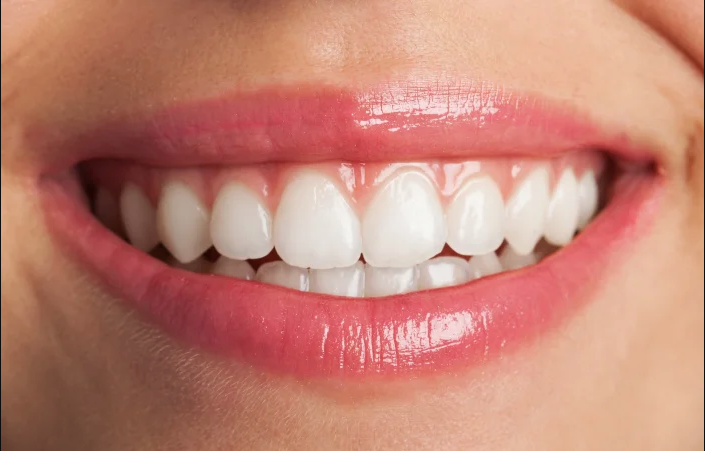 Close-up of a smiling mouth with bright white teeth and pink, glossy lips.