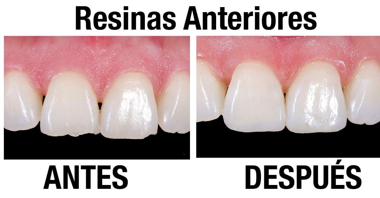 DRA. PATRICIA SERRANO ANAYA - Rehabilitación dental