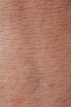 Re:berry Clinic Hongdae