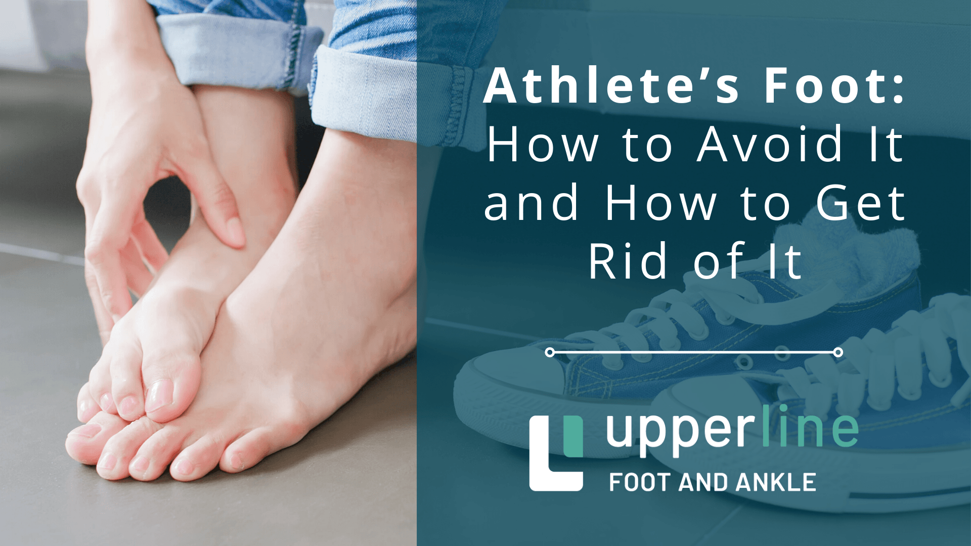 how to avoid athlete's foot How to avoid athlete's foot