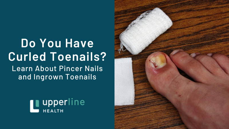 curled toenails